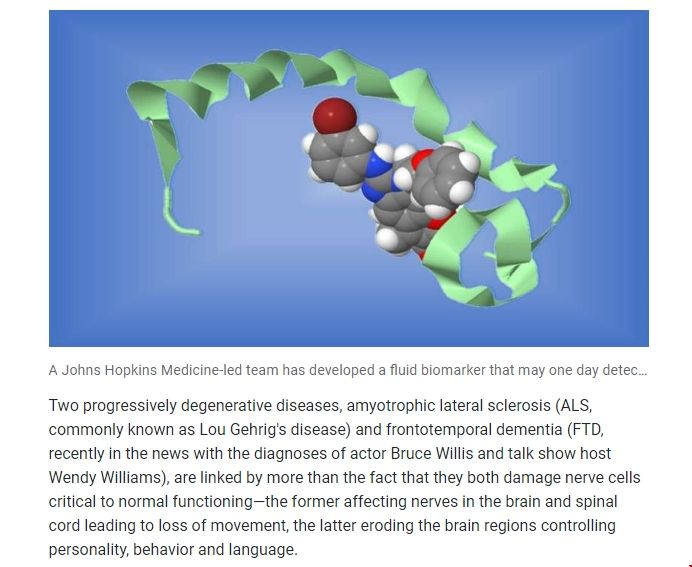 JHU大學發現ALS和FTD病癥的生物標志物.png