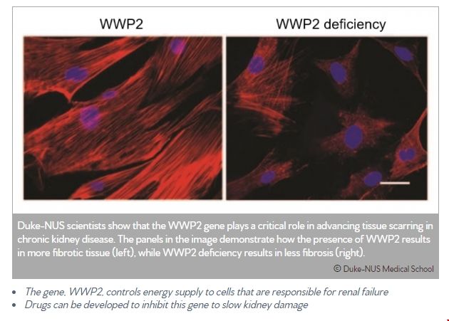 NUS發現阻止慢性腎病新方法.png NUS發現阻止慢性腎病新方法.png